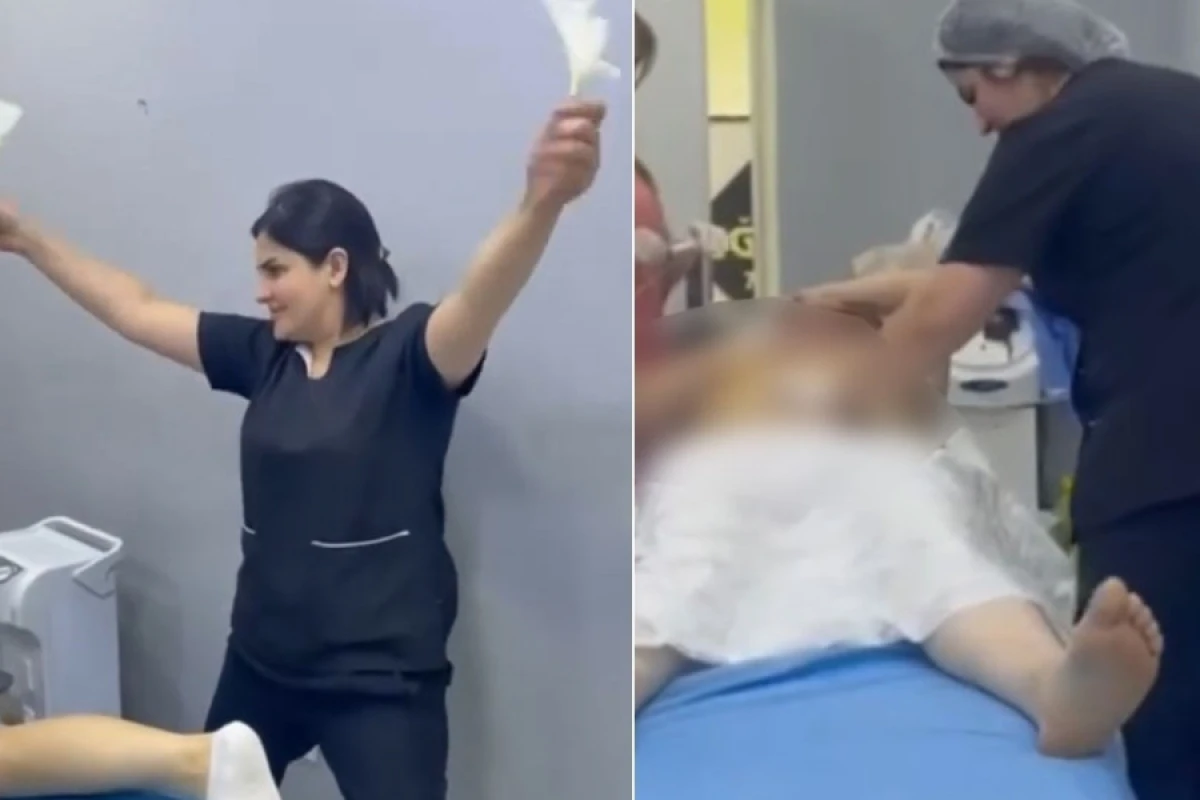 Sosial şəbəkədə [[estetik əməliyyatla bağlı yayılan görüntülərə]] aydınlıq gətirildi