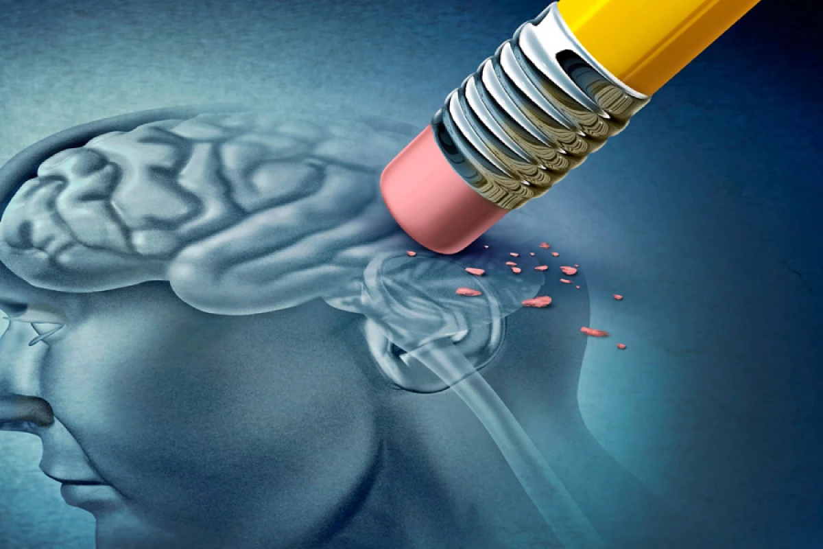 İtaliyada 1,1 milyon insan Altsheymer xəstəliyindən əziyyət çəkir