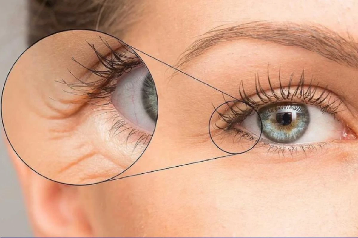 Məşqlər görmə qabiliyyətini [[bərpa edə bilər?]]