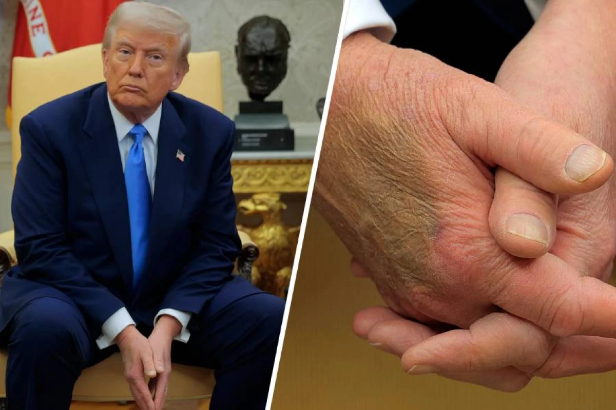 Qanaxma, göyərmə… [[— Trampa nə olub?]]