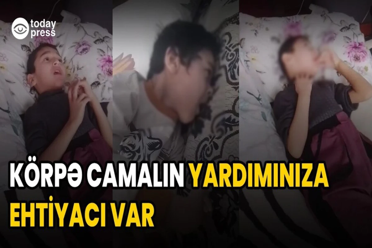 Bir iynənin qiyməti 1200 manatdır… [[- Camala yardım edək – VİDEO]]