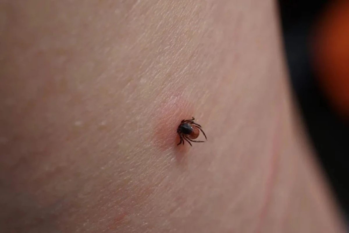 Hansı insanlar gənələri [[cəlb edir?]]