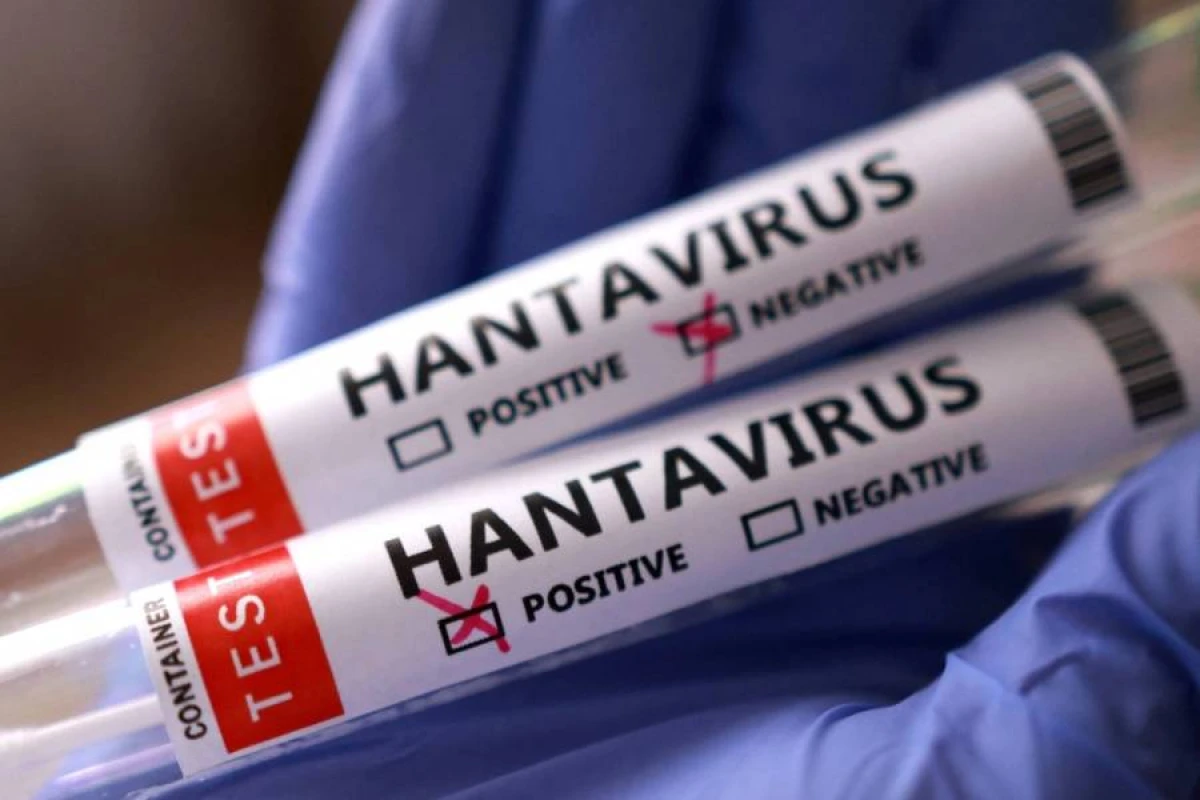 Hantavirus Kanadada da ortaya çıxdı - KİV