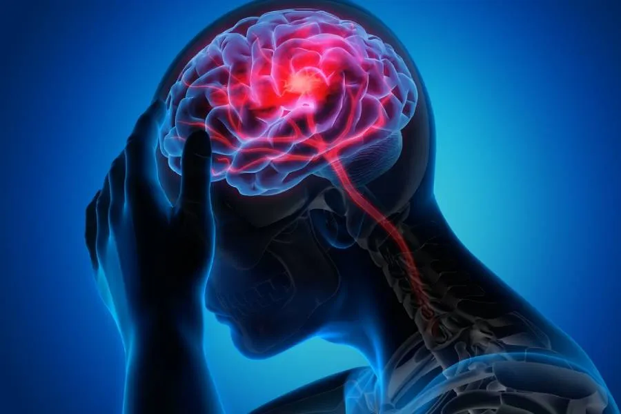 Beyin şişlərinə qarşı yeni silah - Kəllədə gizli immun mexanizm aşkarlandı