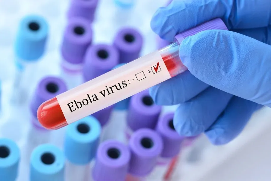 “Ebola” epidemiyası böyüyür: Konqoda ölənlərin sayı 4 mini keçdi